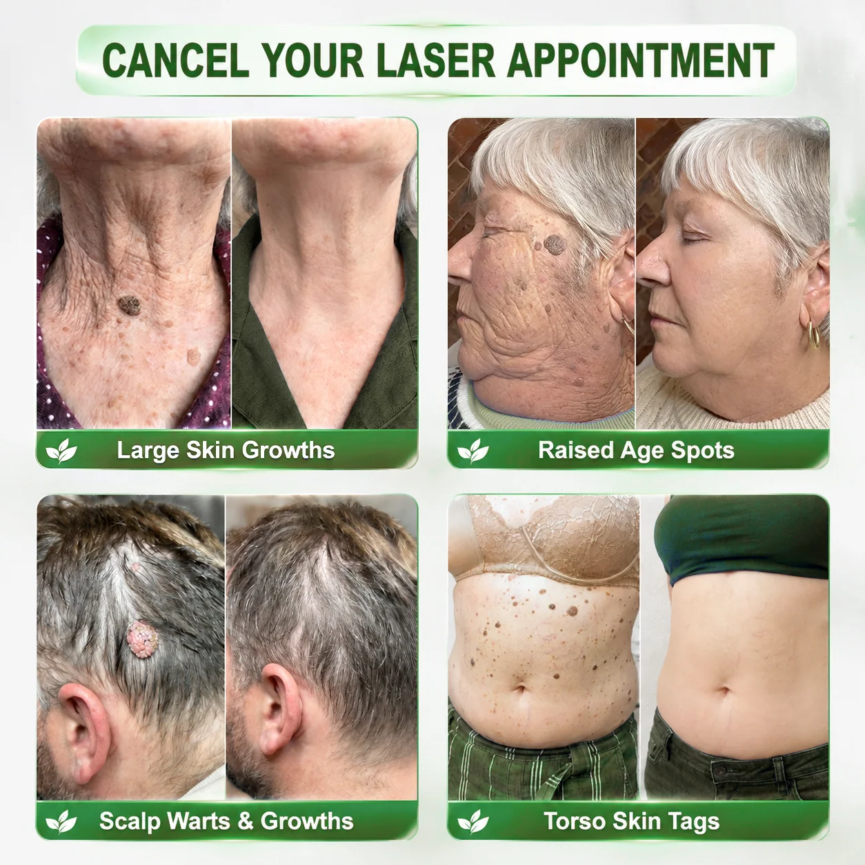 Wait — your order is confirmed! 🎉 Add 𝑯𝙞𝙨𝙠𝙞𝙣® 🧬 PDRN Anti-Aging & Targeted Spot Renewal Stick for wrinkles, crepey skin & dark spots — and enjoy 2X boosted results. 👉 Add now & save 50% — only on this page!