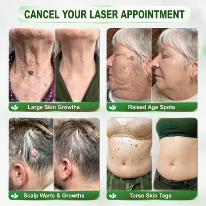 Wait — your order is confirmed! 🎉 Add 𝑯𝙞𝙨𝙠𝙞𝙣® 🧬 PDRN Anti-Aging & Targeted Spot Renewal Stick for wrinkles, crepey skin & dark spots — and enjoy 2X boosted results. 👉 Add now & save 50% — only on this page!
