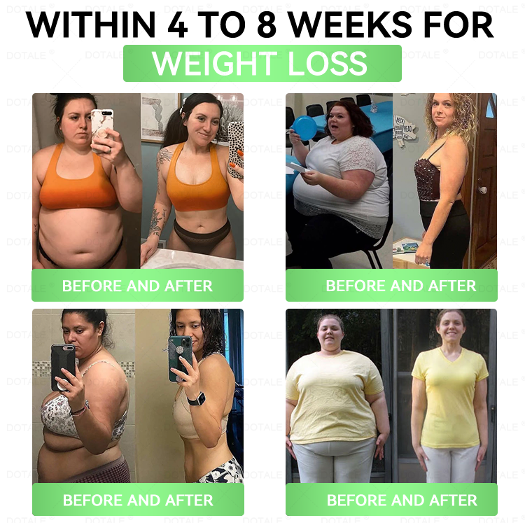 2026 New & Upgraded: 90% OFF ✅ 𝑫𝑶𝑻𝑨𝑳𝑬® Lymphatic Drainage Slimming Nan