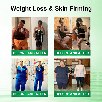 2026 New & Upgraded: 90% OFF ✅ 𝑫𝑶𝑻𝑨𝑳𝑬® Lymphatic Drainage Slimming Nan