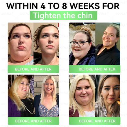 2026 New & Upgraded: 90% OFF ✅ 𝑫𝑶𝑻𝑨𝑳𝑬® Lymphatic Drainage Slimming Nan